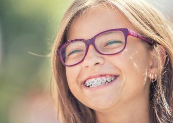 dental braces